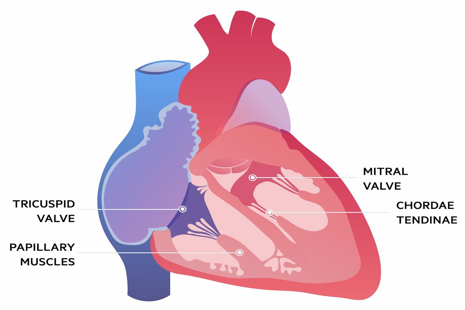 What Are The Effects Of Mitral Stenosis